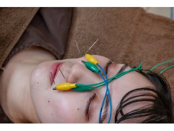 高田馬場はりきゅう院/鼻の症状への鍼灸