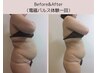 一押し！【ぽっこり下腹に】フェムセラ×電磁パルス 骨盤底筋＆下腹集中ケア