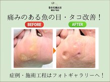 巻き爪補正店 横浜戸塚店