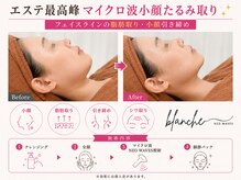 オリエンタルローザ 表参道(Oriental Rosa)/一撃でしっかりお肉取りならコレ