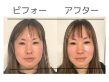 美カナエル(美kanaeru)/鼻すっきり+小顔でパッチリ目元