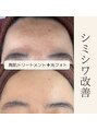 エノアビューティー(ENOA beauty)&nbsp;シミシワ毛穴解消ハーブピーリング＆光美顔フォト