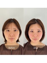 ハリオン 中目黒(HARI-ON)/初回　BeforeAfter