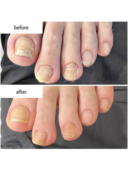 ケアプラス(care plus)/フットネイルケア