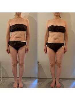 ラナ 京都西院店(Lana)/黄土漢方よもぎ蒸し＆マッサージ