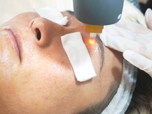 ウェルネスマルカ(wellness MARCA)の雰囲気（特殊ハンドピースで眉下、鼻毛への照射が可能。）
