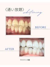 ホワイト 川越店(WHITE)/歯のBefore→After