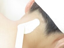 アステキ(ASUTEKI)/うなじ脱毛＋フェイシャルwax