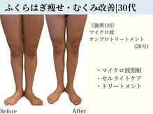 京都フォーエイチ(京都4H)/むくみゼロ！華奢なふくらはぎに