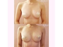 サロン アイミー(salon i me)の雰囲気（【症例】半年の変化/育乳のプロが育ちにくい原因を徹底解明！）