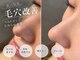 ファースト(1st)の写真