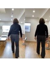 ランドル(rendre)/60代女性　歩行時に股関節が痛い