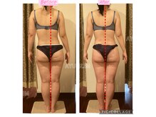 アユスリム(AYU SLIM)の雰囲気（1人ひとりに合わせたオーダーメイド痩身施術で美ボディメイク◎）