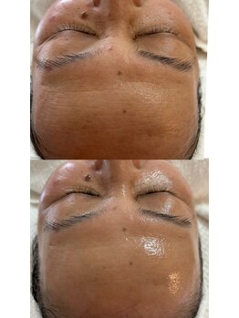 ウララカ(uraraca)/感動して頂きました!