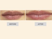 トゥジュール(Toujours)/リップエステ☆