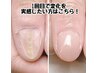 【長さ出しあり】深爪矯正｜爪先強化＋ワンカラー仕上げ