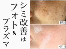 レイ(Rey)の雰囲気（フォトでくすみ改善＆美白肌へ。一度で驚きの結果。）