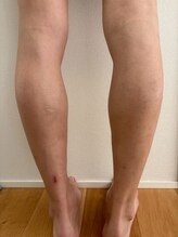 ブルーココア(BlueCocoa)/メンズ脚。ふくらはぎ