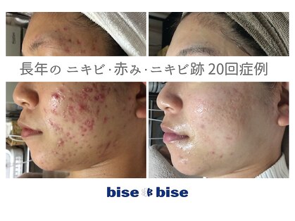 ビズビズ 梅田店(bisebise)の写真