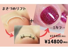 ワンミリオン(one million)の雰囲気（巻き爪リフト（両足親指）とジェルネイル1カラーのセット￥14800）