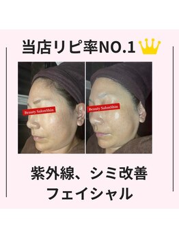 シン(Shin)/【紫外線、シミケア】