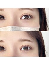 イルム ビューティー アンド ライフ(iLM beauty and life)/次世代まつげパーマ