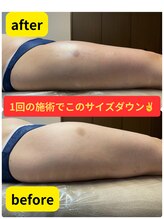 サロン イフ(salon if)/太もものサイズダウンも可能！！