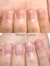 マリーロール 天王寺店(Marie Laure)/深爪改善/自爪育成/ネイルケア