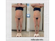 ミル(miru)の雰囲気（痩身全身デトックス120分#インディバ#痩身#堀江#難波）