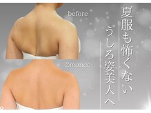 ソナ 大和西大寺院(SONA)/【夏季限定☆うしろ姿美人へ♪】