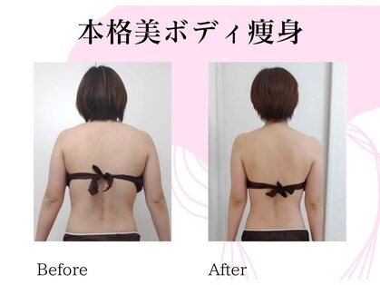 ユニクリア(Uni clear)の写真