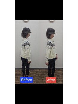 最後の整体 練馬駅前院/腰痛でお悩みの方の体の可動域