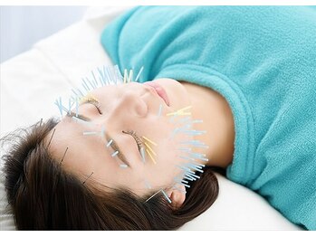 ピュアハリの写真/《笑顔が素敵な女性に変身!》美容鍼でググッとリフトUP◎加齢によるたるみやほうれい線のお悩みを徹底改善!