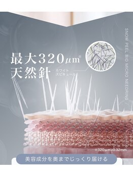 ラズ(Luz)/雪花ピール