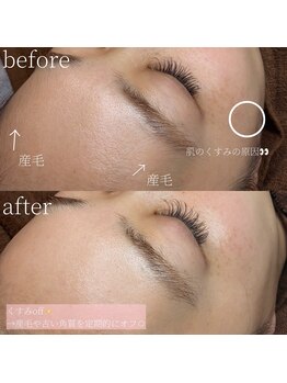 コモレビ(komorebi)/ざらつき改善・フェイスワックス