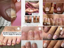 爪家の雰囲気（爪のトラブルはこちらをご覧下さいInstagram @jizume.kirei.nail）