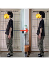 カイロプラクティック 楓/姿勢改善　例