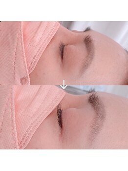 アリス(a'Rice)/次世代まつげパーマ