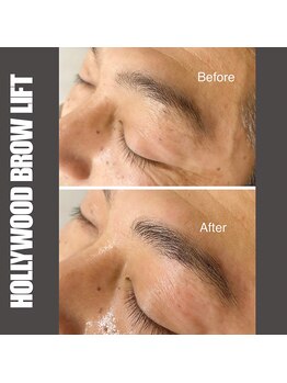 セラス(CERAS)/ハリウッドブロウリフト