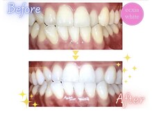 エクシアホワイト 長野店/ビフォーアフター