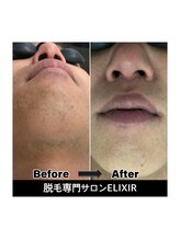 エリクサー 太田店(Elixir)/before after