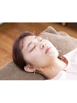 鍼灸施術を受けたい