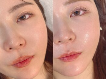 エミュ(emu)/顔ダニ撃退!艶々もっちりお肌に