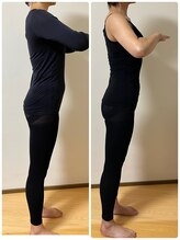 リンドール(RinDoll)/50代女性ダイエット/耳ツボ/痩身