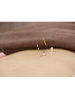 鍼灸施術を受けたい