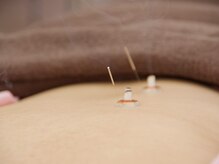 たかみや鍼灸接骨院