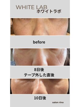 サロン リノ(salon rino)/ホワイトラボ