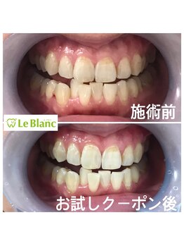 ルブラン 奈良店(Le Blanc)/1日1回は歯、みますよね？？