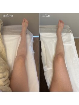 ジェニー(JENNI)/痩身７０分