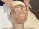 サロン ジョリー(Salon jolie)の写真/【☆本気肌質改善☆最新国産ハーブピーリング&プラズマシャワー】剥離なしのピーリング使用でDTなし！